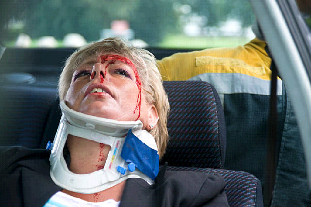 Hidden Injuries After a Car Crash